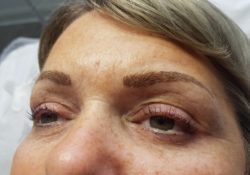 Permanent Eyebrows