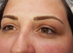 Permanent Eyebrows