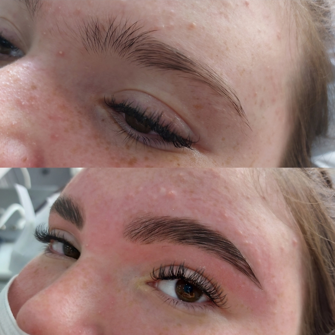 Brow Lamination